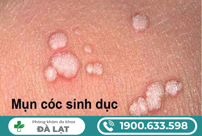 Hình ảnh minh họa